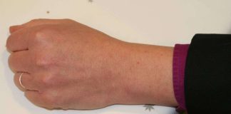 Yksi piispa on ilman rannekelloa