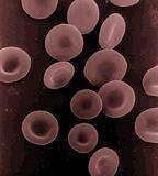 K&K: Kuivaveripalvelu väittää paljastavansa veren syntisyyden