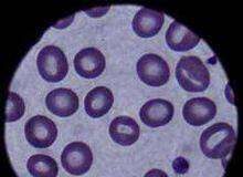 Uskontokunnat syntimittarista: Verestä ei syntejä näe