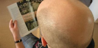 Syntiset hiustyylit ovat Suomessa arkipäivää